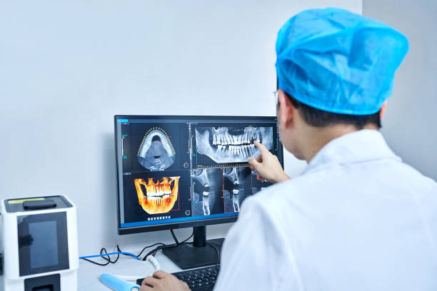 Best Emergency Wisdom Tooth Extraction in Fort Wayne, IN
